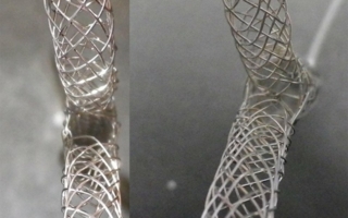 Flechten-Stents.jpg