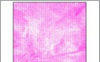 Ultraschallschweißen 